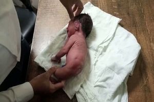 تولد نوزادی عجیب در هندوستان