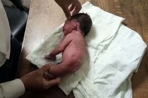 تولد نوزادی عجیب در هندوستان