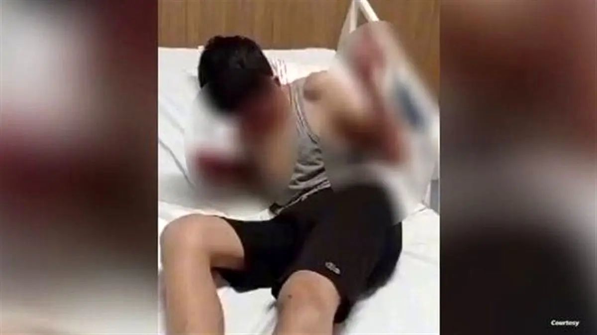 کودک سوری در ترکیه بهشدت مضروب شد