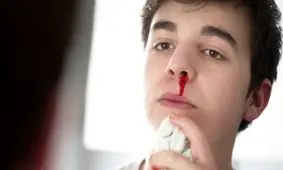 هنگام خونریزی بینی چه کنیم؟