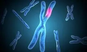 سندرم ایکس شکننده؛ چند سوال و جواب درباره یک بیماری که قابل درمان نیست!