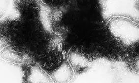 ویروس سین‌سیشیال تنفسی چیست؟

