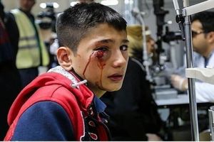 قطع عضو ۵۰ نفر و ۱۶۶ مورد آسیب به چشم در آیین چهارشنبه سوری