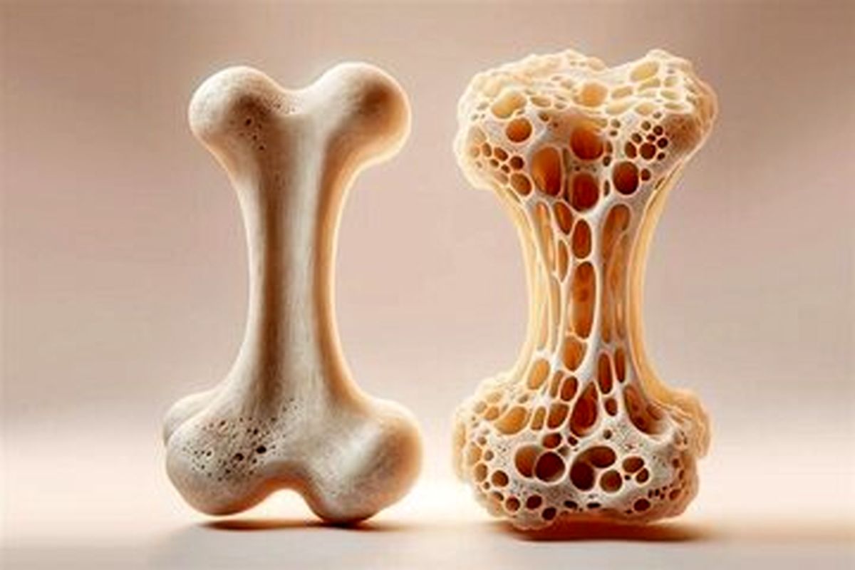  نجات استخوان ها از پوکی به کمک این مواد معدنی 
