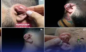 چند می گیری گوش بشکنی؟