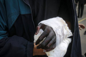 سه اراذل و اوباش «نوپا» دست یک شهروند را قطع کردند