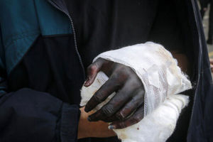 سه اراذل و اوباش «نوپا» دست یک شهروند را قطع کردند