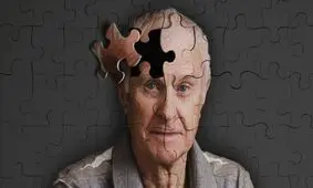 شناسایی نقش یک انتقال دهنده عصبی در کنترل آلزایمر