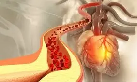 ادویه ای که کلسترول خون را کاهش می‌دهد