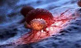 درمان توده های سرطانی با کمک نانوذره‌های مغناطیسی