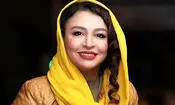 تغییر چهره مه‌لقا باقری بعد از شایعات اخیر/ عکس