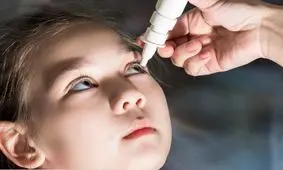 پلک زدن بیش از حد در کودکان