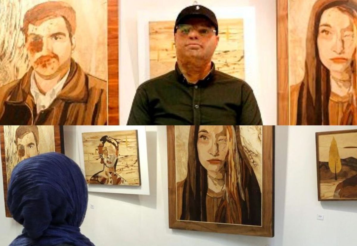 اسیدهایی که جان میسوزانند