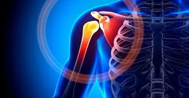 شانه یخ زده چیست؟