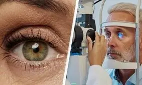 کمیاب‌ترین رنگ چشم در جهان/ تصاویر

