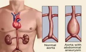 اگر می‌توانید این کار را با انگشتتان انجام دهید ممکن است در معرض خطر مرگ باشید
