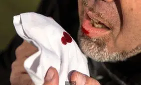 چالش افزایشی بودن سل