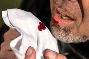 چالش افزایشی بودن سل