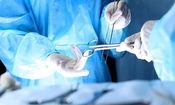 خارج کردن ۴۷ پیچ تیز از معده یک بیمار در کرج/ عکس