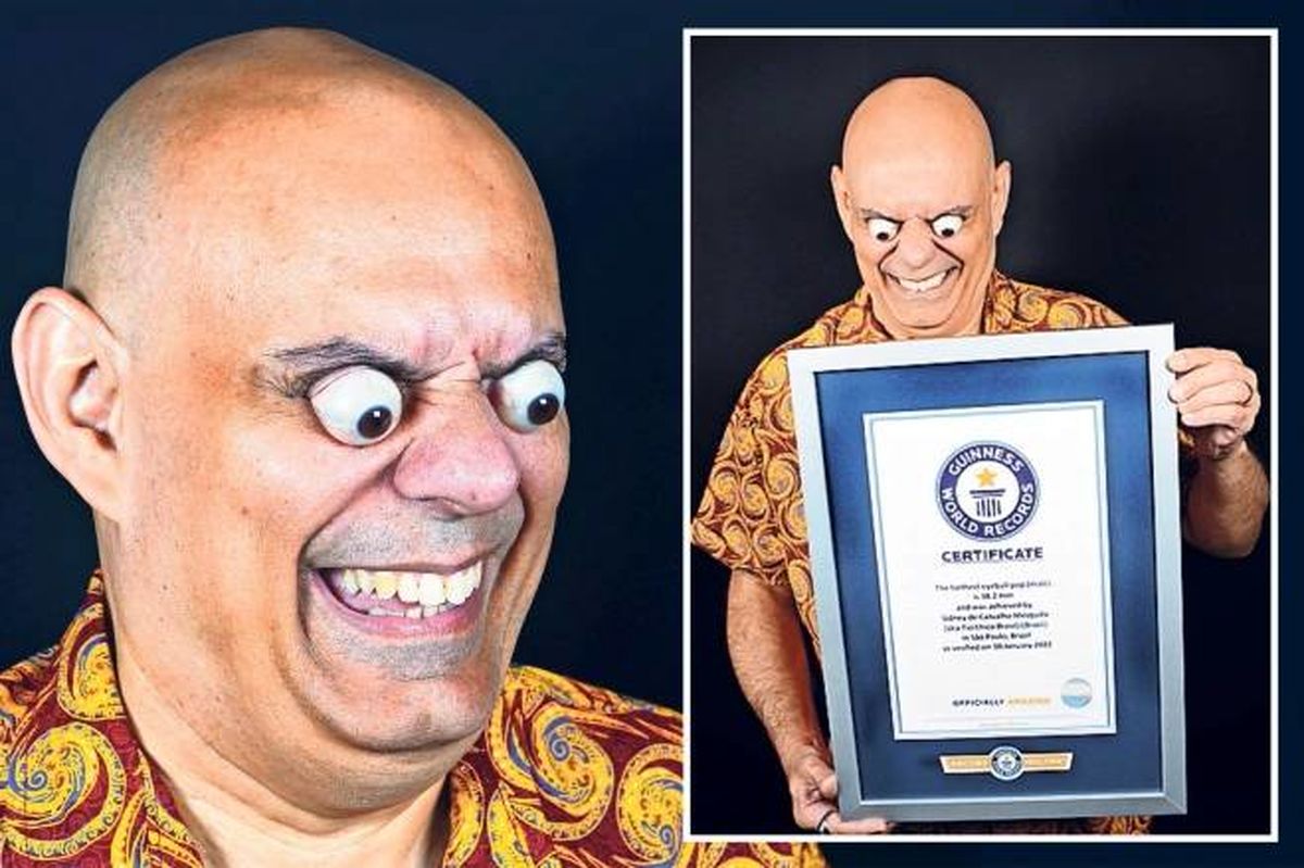 چشمان از حدقه بیرون زده این مرد نام او را در رکوردهای گینس ثبت کرد