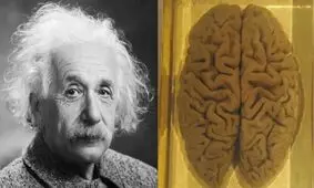 مغز آلبرت انیشتین چگونه دزدیده شد؟


