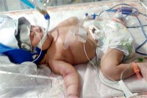 فوت یک نوزاد در بیمارستان علیمرادیان نهاوند
