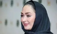 عکس جدید خانم بازیگر با چهره‌ای که به‌سختی می‌توان شناخت!

