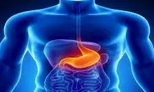 بهترین مکمل برای کاهش اسید معده چیست؟
