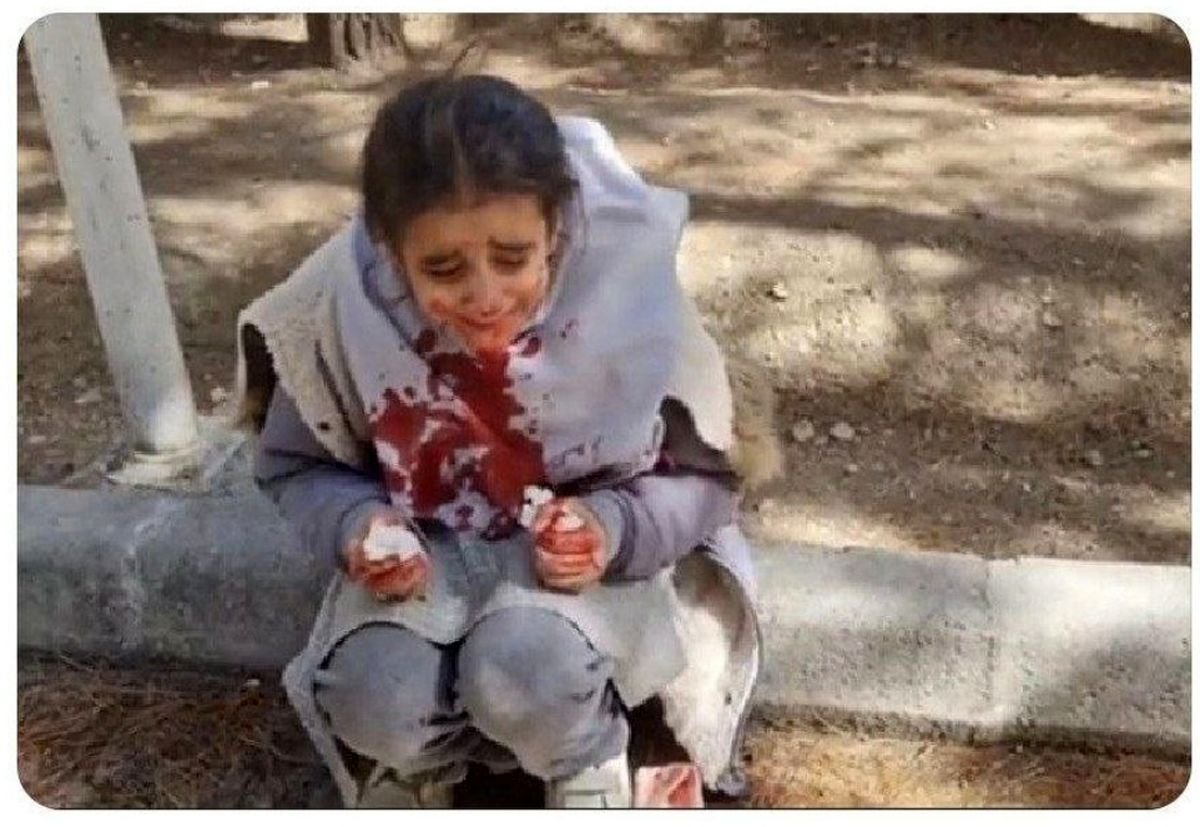 ماجرای صورت خونآلود دانشآموز اصفهانی چیست؟/ پیگیری ها در مورد ربط موضوع با حجاب، ادامه دارد