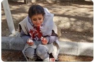 ماجرای صورت خون‌آلود دانش‌آموز اصفهانی چیست؟/ پیگیری ها در مورد ربط موضوع با حجاب، ادامه دارد