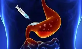 آیا بوتاکس معده برای همه افراد چاق کارایی دارد؟

