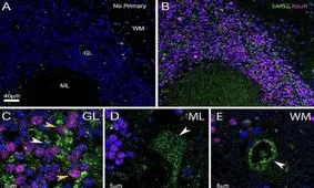 وجود کروناویروس در مغز و قلب مبتلایان به کووید-۱۹ طولانی

