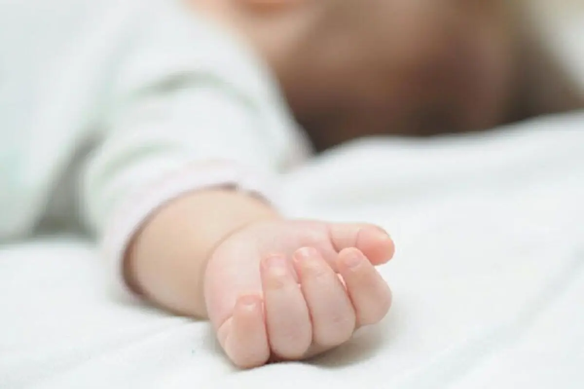 کودک نیشابوری دچار سوختگی پس از تلاش ۱۰ روزه کادر پزشکی جان باخت