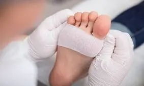 ترکیب هیدروژل و اگزوزم به کمک زخم‌های دیابتی می‌آیند


