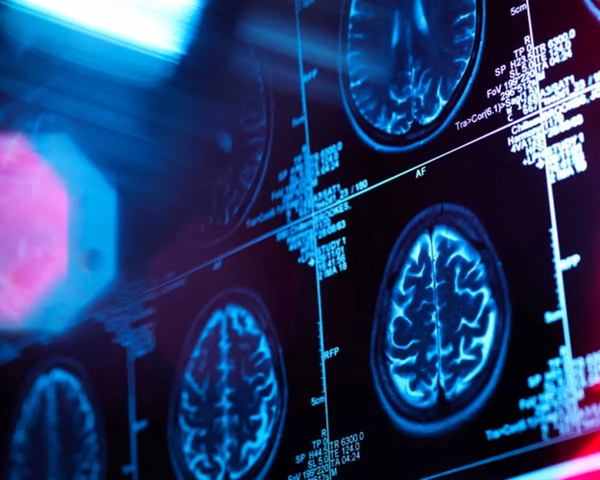 دانشمندان 5 «دوره» اصلی رشد مغز انسان را شناسایی کردند

