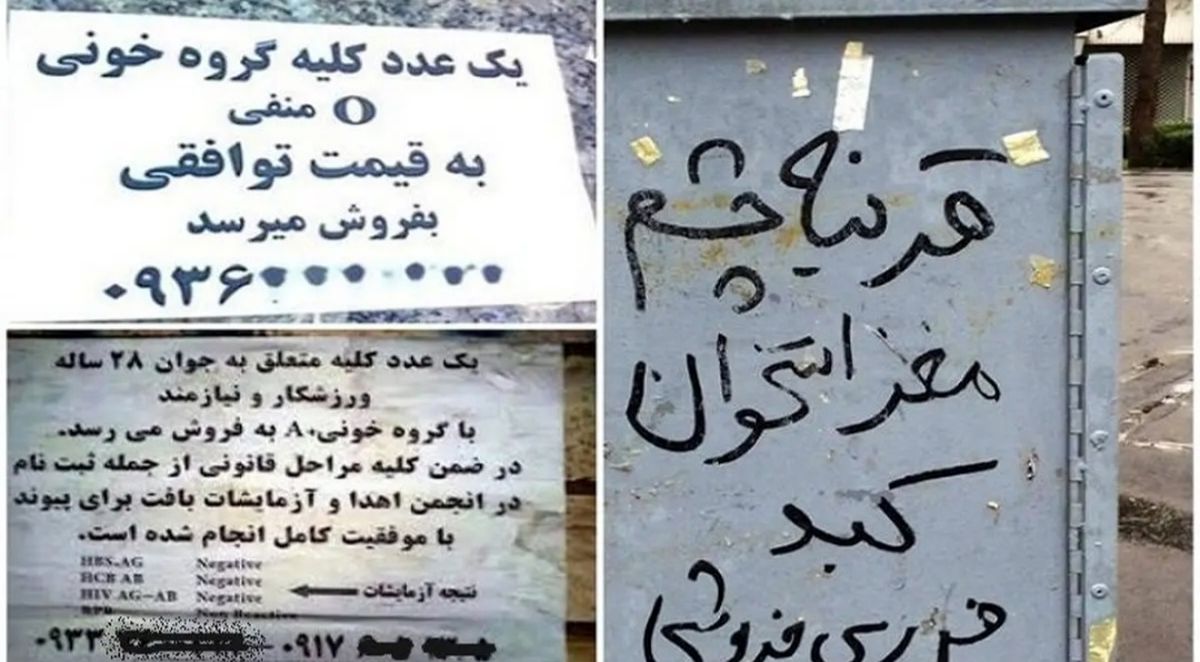  قیمت جان؛ کبد و کلیه ۴۰۰ میلیون تومان! 