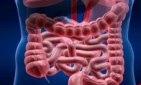  ۷ ماده غذایی موثر در پاکسازی روده بزرگ/ اینفوگرافی