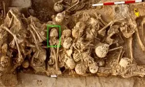 زنی با «جمجمۀ مخروطی» بعد از 6 هزار سال در «خوزستان» از زیر خاک بیرون آمد