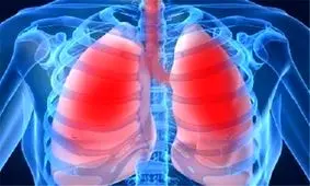 ویتامین هایی که از بیماری های ریوی جلوگیری می کنند