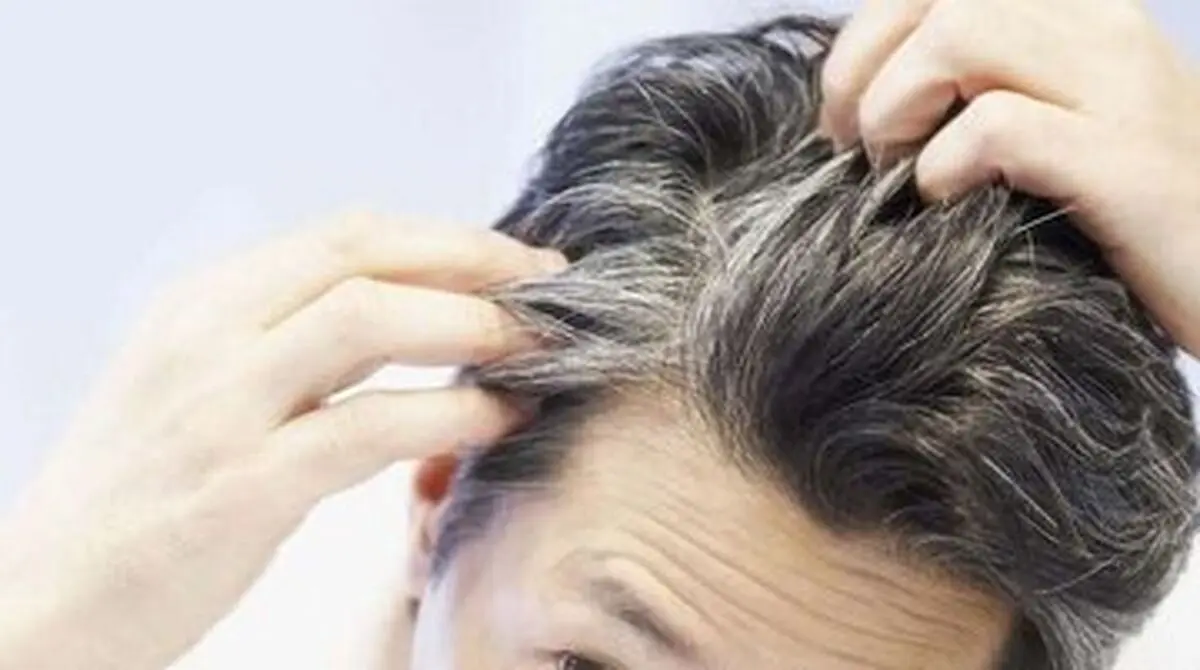 این ۸ مورد به موی سر آسیب می‌رساند