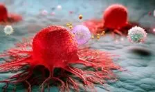 گامی نو به‌سوی غربالگری خانگی سرطان

