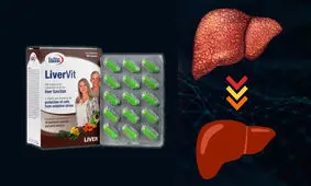 پاکسازی کبد چرب گرید 2 با مکمل لیورویت