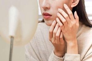 زیبایی پوست صورت به کمک طب سنتی