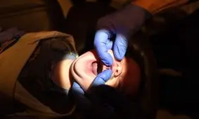 درون تجارت پررونق بریدن بند زبان نوزادان در امریکا