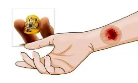 درمان سریع تر زخم ها با چسب زخم هوشمند