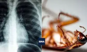 سوسک 4 سانتی‌ متری که در ریه یک هندی زندگی می‌کرد