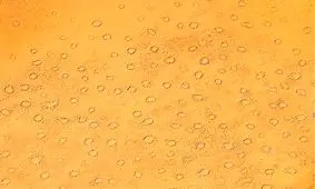 حلقه‌های اسرارآمیز در دل صحرای نامیب از کجا آمده‌اند؟