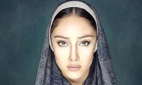 ترلان پروانه: هیچ عمل زیبایی نکردم