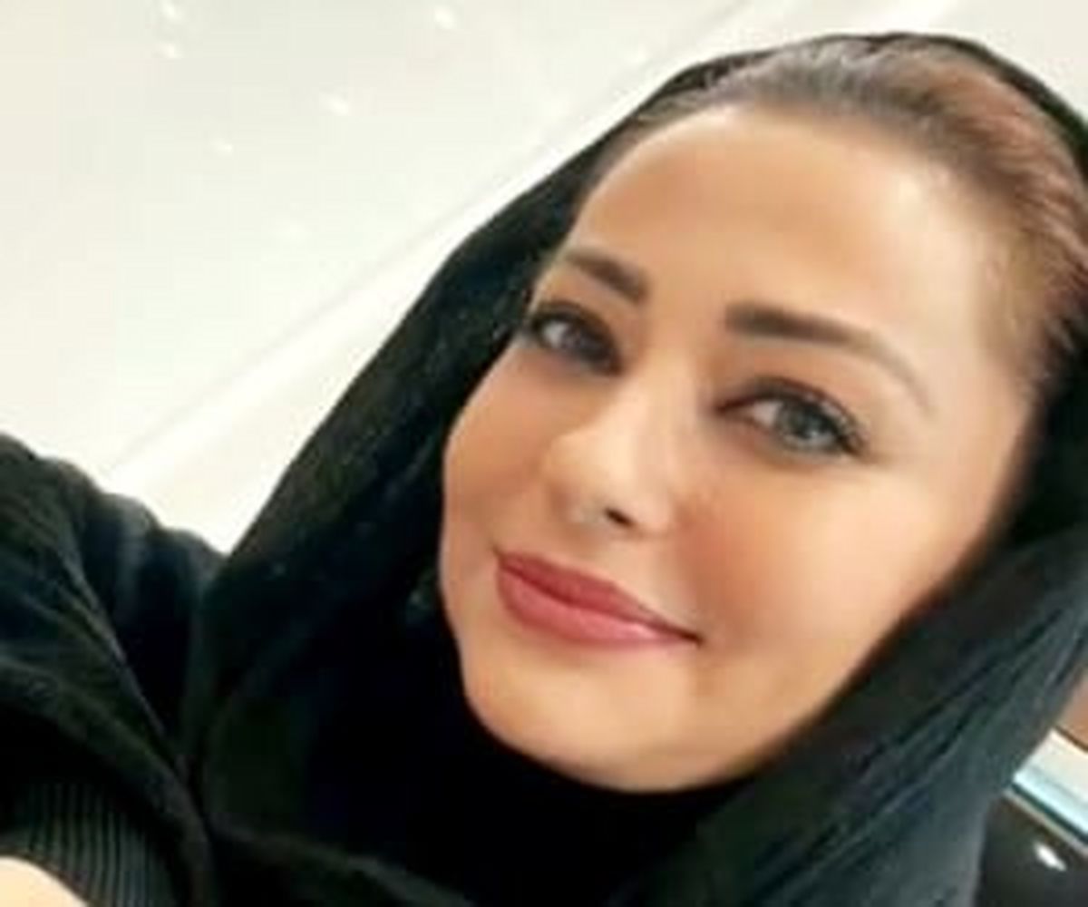 بازیگران زن ایرانی بدون عمل زیبایی 