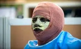 چگونه به افرادی که دچار سوختگی شده اند کمک کنیم؟